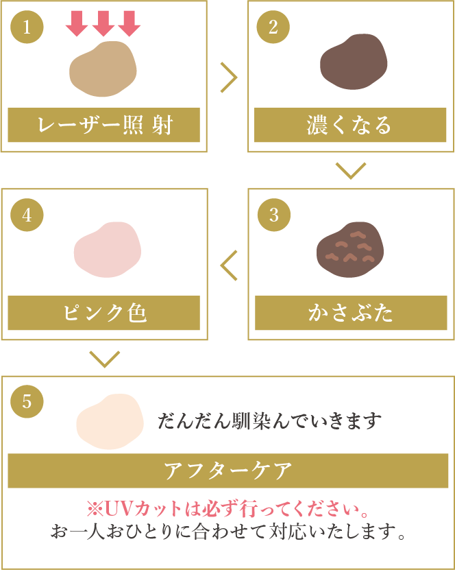 レーザーを当てたしみの反応や経過